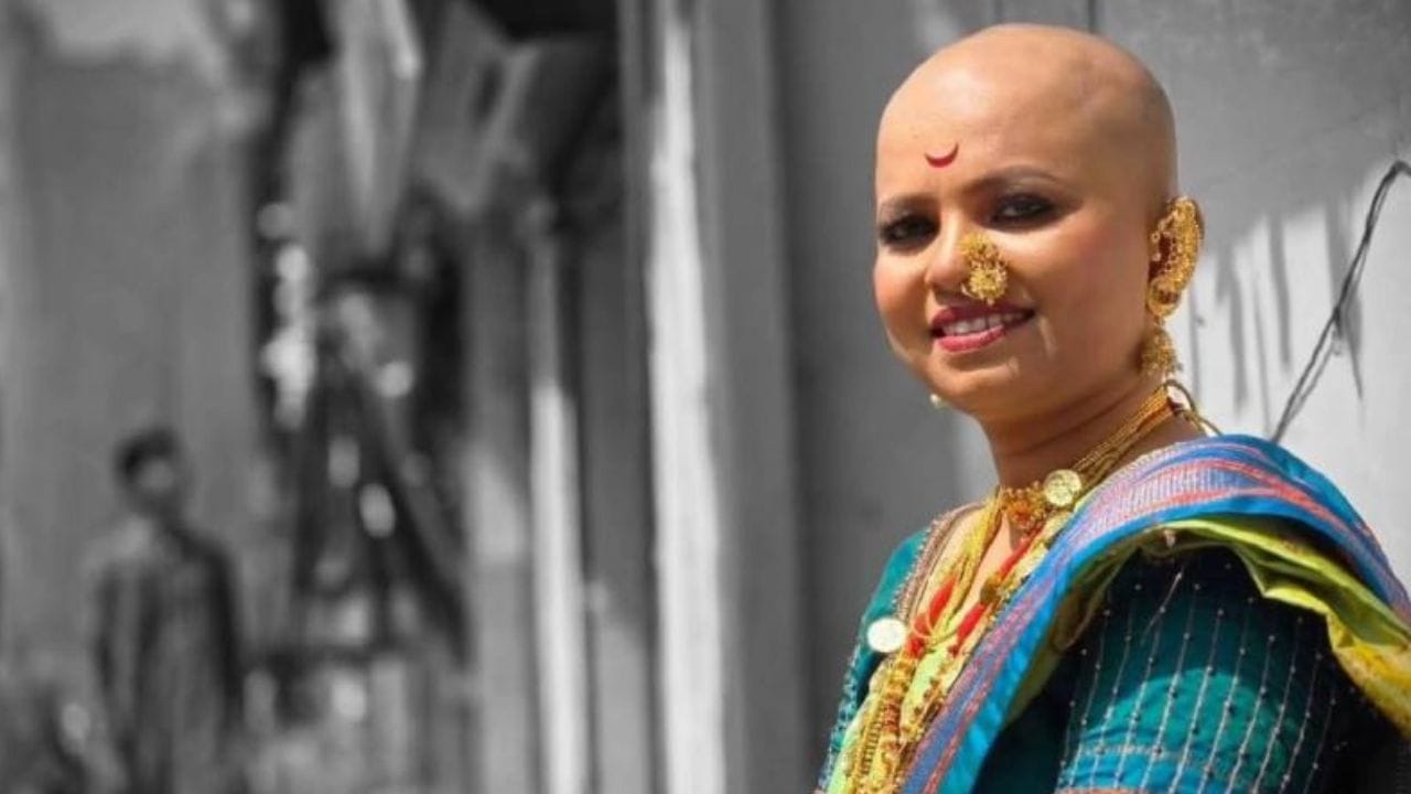 काही ठिकाणी तिने विगही वापरला. पण सत्य जे काही आहे ते कधीच स्वीकारणे बंद केले नाही. काही चित्रपटात तिने काम केले. पण तिने कधीच यामुळे आपला आत्मविश्वास गमावला नाही.