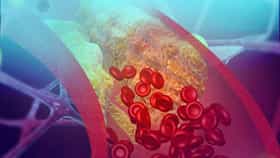 High Cholesterol : शरीरातील कोलेस्ट्रॉल वाढले? या आजारांचा धोका वाढतो, वेळीच लक्ष द्या